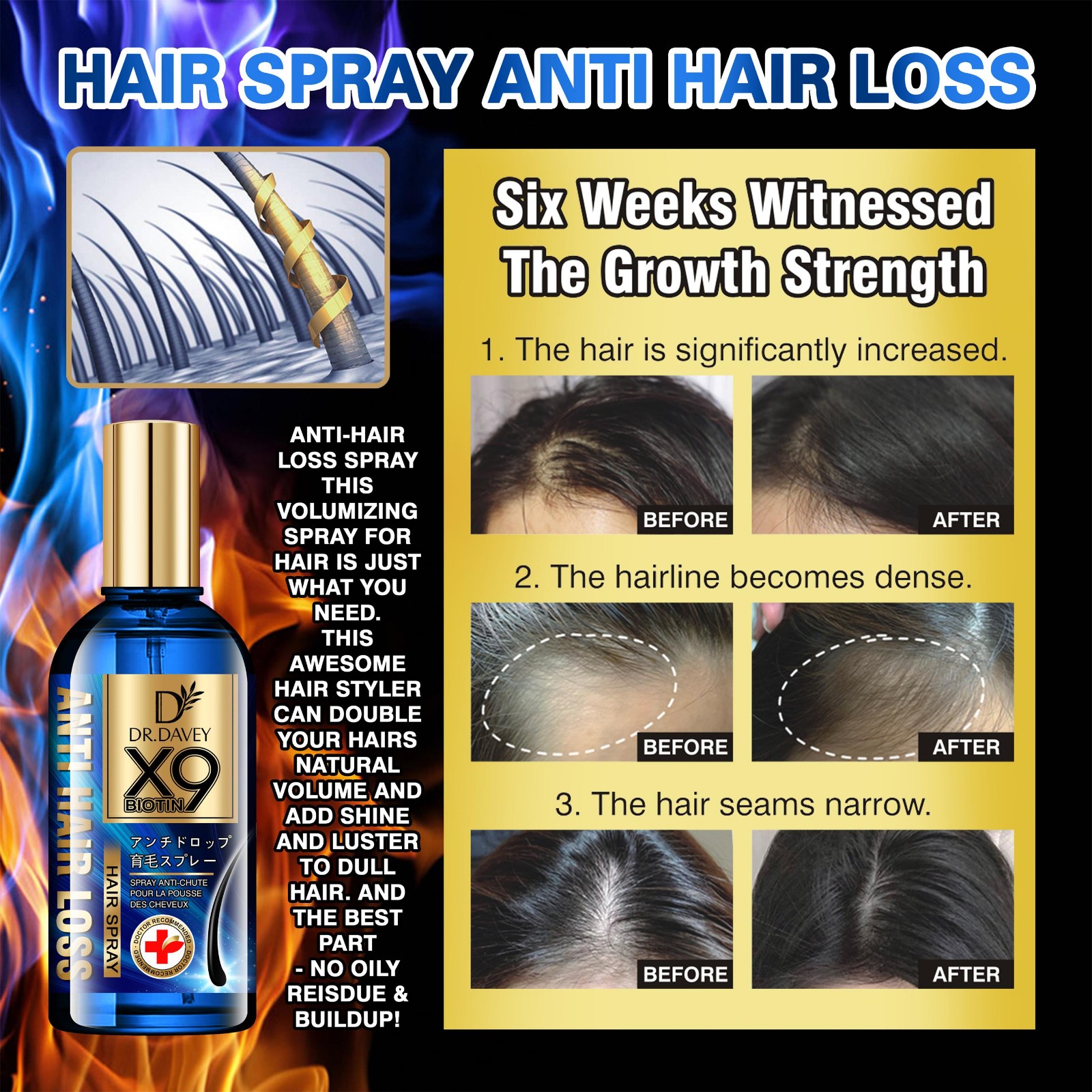  Hair Loss Hair Spray